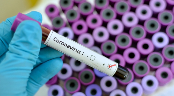 Navarra readapta la aplicación del protocolo de detección a la nueva situación epidemiológica 